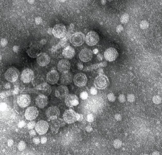 Hepatitis B virus.jpg